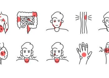Medical illustration of granulomatosis with polyangiitis symptoms