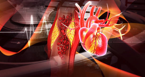 Digital illustration of a human heart and artery showing disrupted blood flow and arrhythmia