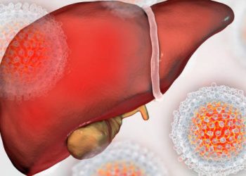 Illustration of an inflamed liver surrounded by hepatitis C virus particles