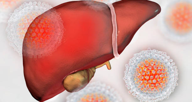 Illustration of an inflamed liver surrounded by hepatitis C virus particles