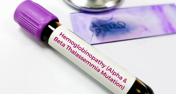 Blood sample labelled for haemoglobinopathy testing including alpha and beta thalassaemia mutation