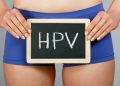 Human Papillomavirus