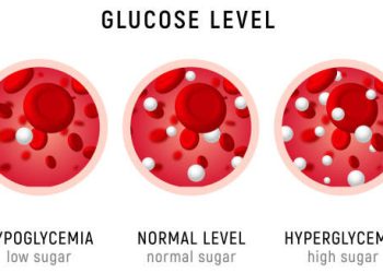 Visual comparison of hypoglycaemia, normal glucose, and hyperglycaemia in blood