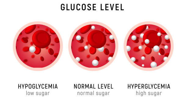 Visual comparison of hypoglycaemia, normal glucose, and hyperglycaemia in blood