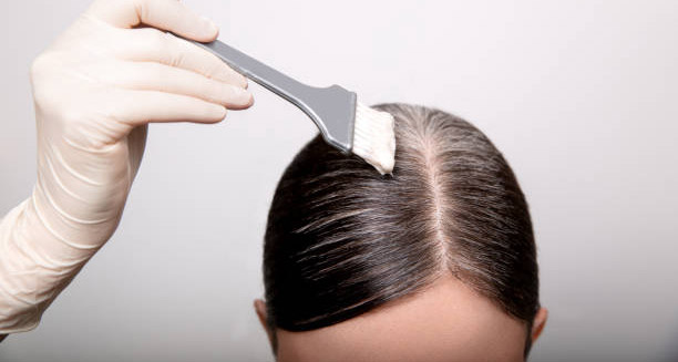Hair dye being applied to scalp under careful supervision