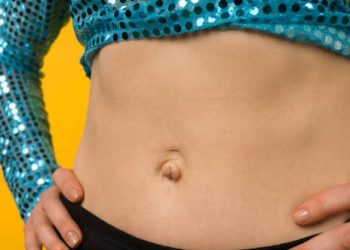 Close-up of a woman's abdomen with an umbilical hernia visible