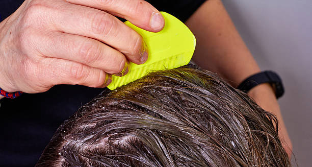 Person using a yellow fine-tooth comb to check wet hair for lice prevention
