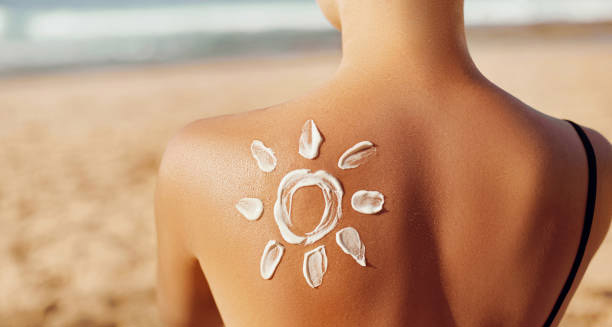 Woman on beach with sun cream in the shape of a sun on her back, symbolising prevention of heat rash