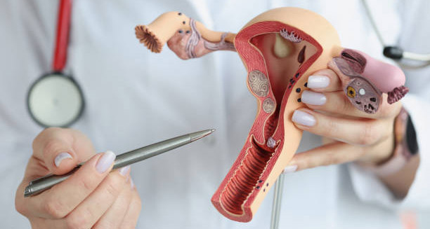 Doctor holding a female reproductive system model while pointing out ways to prevent heavy menstrual bleeding