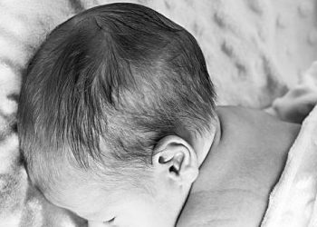 Baby with flat spot on head lying on soft blanket