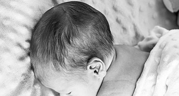 Baby with flat spot on head lying on soft blanket