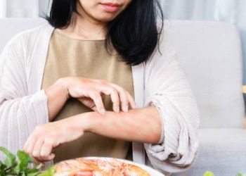 Woman scratching arm due to food colour sensitivity reaction