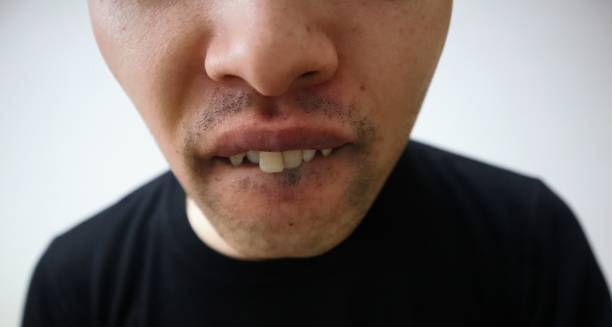 Man with visible gum issues and missing teeth showing symptoms of gum disease