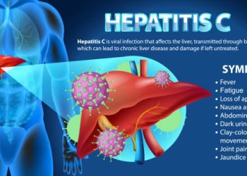 Medical illustration showing liver symptoms and complications of hepatitis C