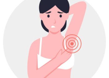 Illustration of a woman with pain and swelling in the underarm, indicating symptoms of hidradenitis suppurativa