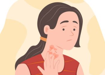 Illustration of a woman scratching red itchy hives on her neck