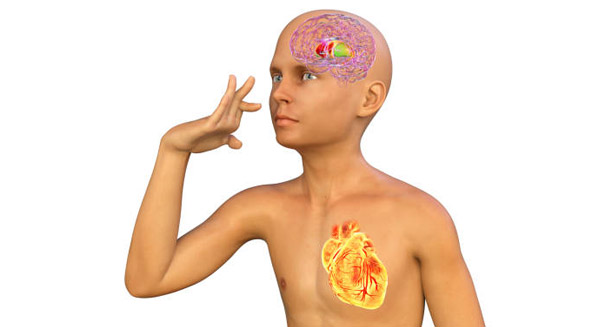 Symptoms of Huntington’s Disease