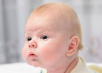 Comparison of normal brain and hydrocephalus showing fluid buildup and pressure in the brain