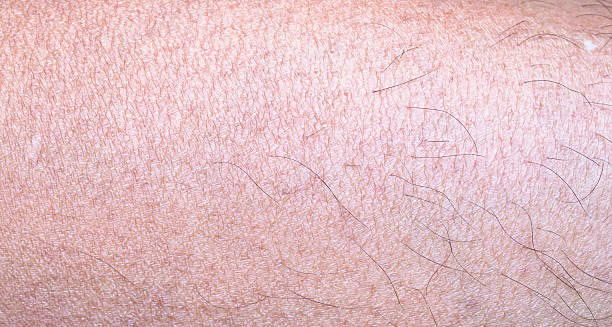 Close-up of dry, scaly human skin with visible flaking and fine cracks.