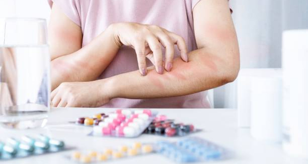 Woman scratching allergic rash on arms with allergy medication on table