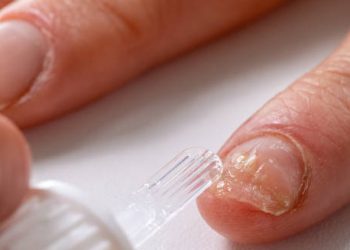 Treatment of Fungal Nail Infection