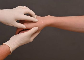 Medical professional examining a patient's wrist for ganglion cyst treatment