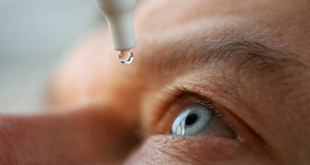 Treatment of Glaucoma