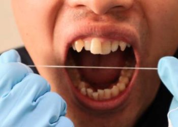 Dentist demonstrating dental flossing as part of gum disease treatment