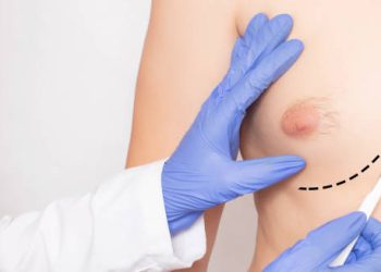 Doctor preparing for male breast reduction surgery