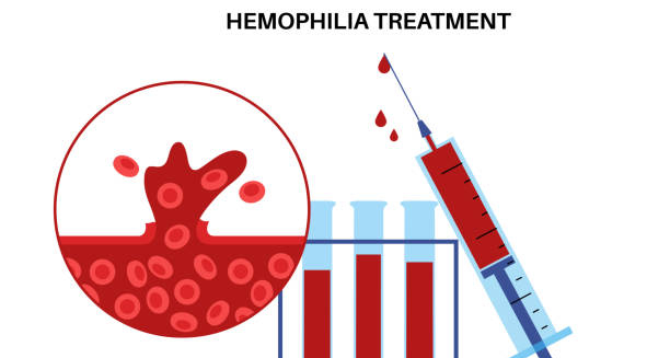 Illustration of haemophilia treatment with syringe and blood samples.