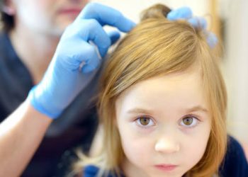Doctor wearing gloves examining young girl’s hair for lice treatment