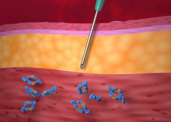 Illustration showing injection of medication into skin layers to treat hidradenitis suppurativa inflammation