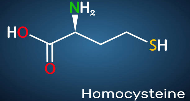 Treatment of Homocystinuria