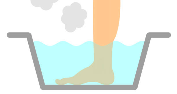 Treatment of Ingrown Toenail
