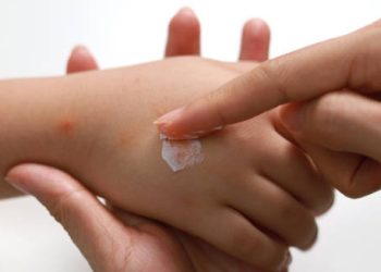 Applying cream to insect bites on a child's hand