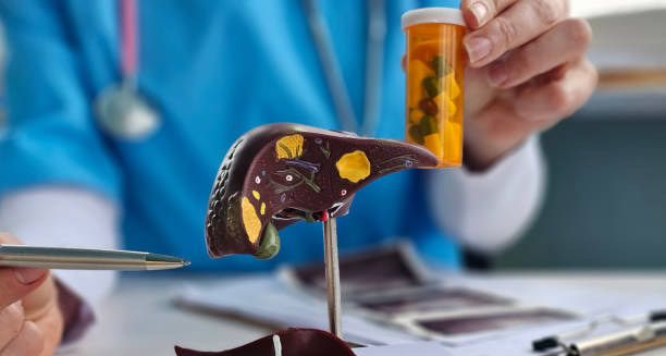 Doctor holding a liver model and medication bottle to explain treatment of jaundice in newborns