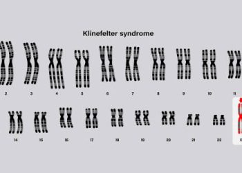Causes of Klinefelter Syndrome