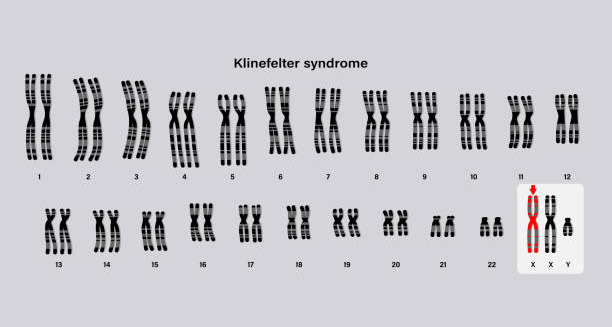 Causes of Klinefelter Syndrome