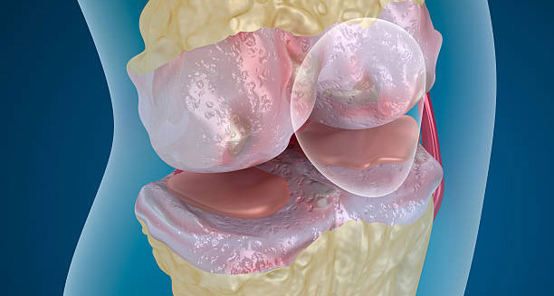 Causes of Knee Cartilage Damage