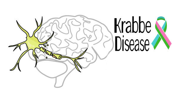 Causes of Krabbe Disease