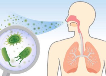 Causes of Legionnaires' Disease