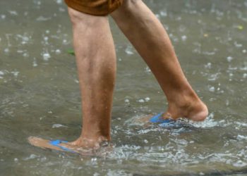 Causes of Leptospirosis