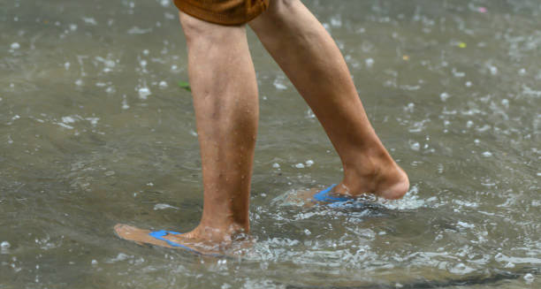 Causes of Leptospirosis