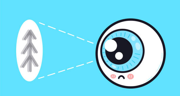 Causes of Long-sightedness