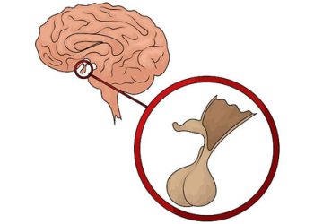 Causes of Low Testosterone