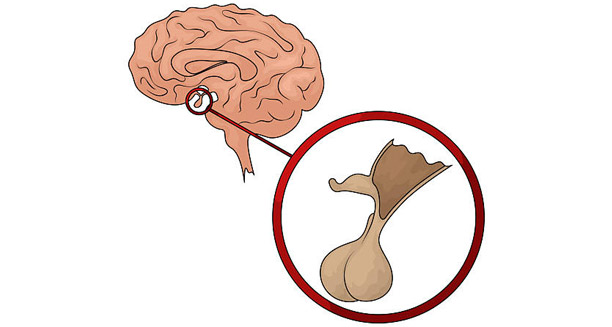 Causes of Low Testosterone