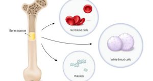 Causes of Low White Blood Cell Count