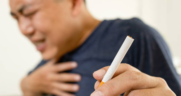 Causes of Lung Cancer