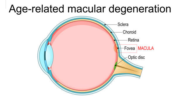 Causes of Macular Degeneration