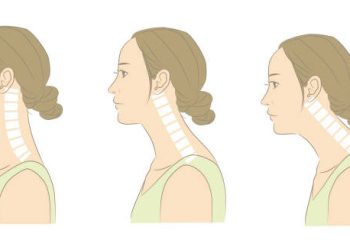 Complications of Kyphosis